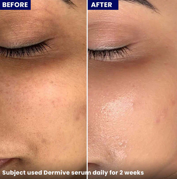 Jenpharm Dermive Hydrating Serum - 20ml